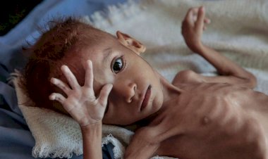 Yemen'de 3 milyonu aşkın kişi açlıkla karşı karşıya