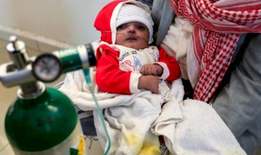 Yemen: 2 milyon çocuk yetersiz beslenme sorunu çekiyor