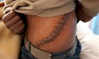 Mısır'da insanlık dışı bir pazar: Organ ticareti