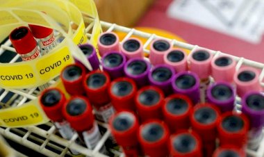 Kan grubu sıfır olanlar koronavirüse karşı daha dirençli