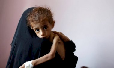 Yemen'de açlık çeken çocukların oranı yeni bir rekor kırdı