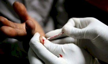 Nijerya'da 1,6 milyon kişi AIDS’ten öldü