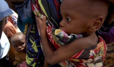 Dünya genelinde 5 yaşın altında 11 milyon çocuk açlıktan ölme sınırında