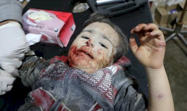 Esed rejimi sivilleri hedef aldı: İkisi kadın biri çocuk olmak üzere 5  yaralı