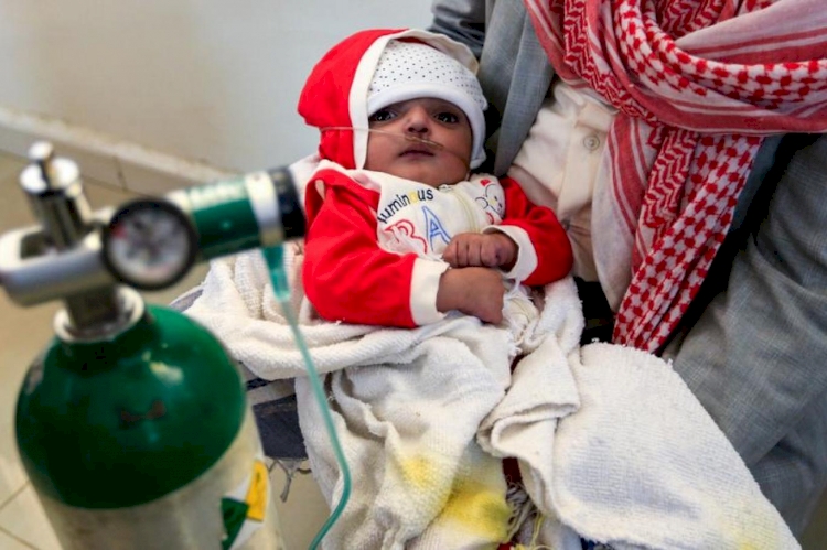 Yemen: 2 milyon çocuk yetersiz beslenme sorunu çekiyor