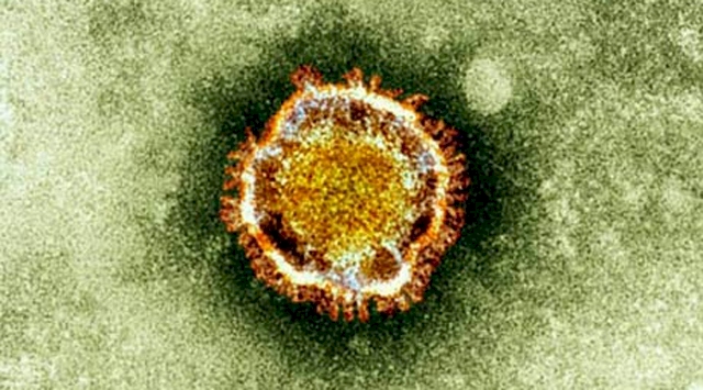 Koronavirüsün hücreleri nasıl etkilediği tespit edildi