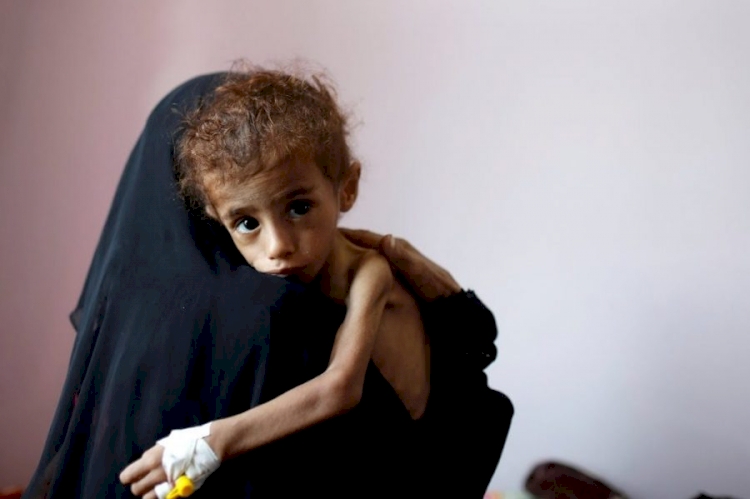 Yemen'de açlık çeken çocukların oranı yeni bir rekor kırdı