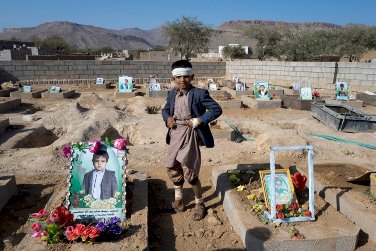 Yemen'de savaşın acı bilançosu: 5 bin 700 çocuk hayatını kaybetti