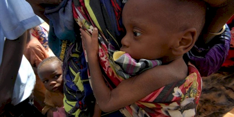 Dünya genelinde 5 yaşın altında 11 milyon çocuk açlıktan ölme sınırında