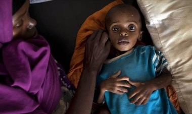 Somali'de kuraklık nedeniyle 3 kişi öldü