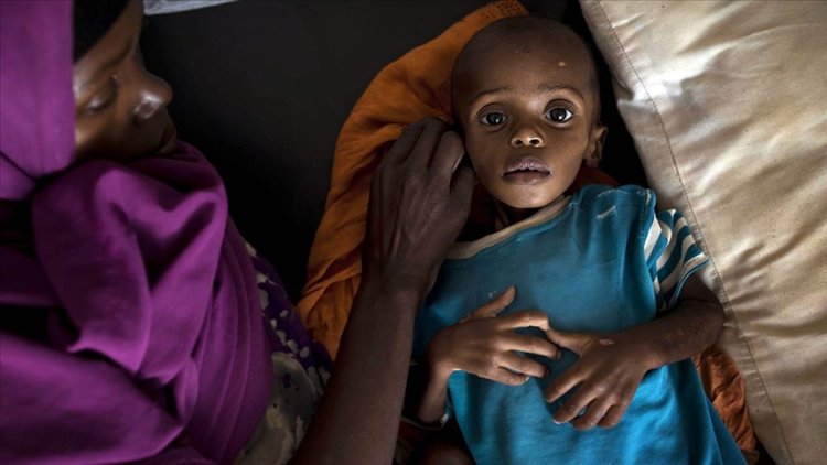 Renkleri ‘farklı’ olsa gündem olurdu ama..! Somali'de iki çocuk ‘açlıktan’ öldü!