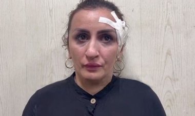 Burun estetiği için 5 günlük bebeğini satan kadın tutuklandı