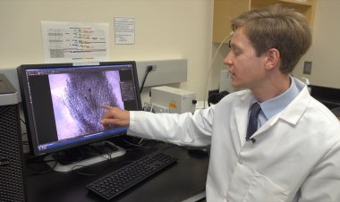 Bilim insanları kellik için potansiyel tedavi keşfetti