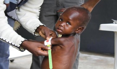 Nijerya'da 1,2 milyon çocuk yetersiz beslenme nedeniyle bodur kaldı