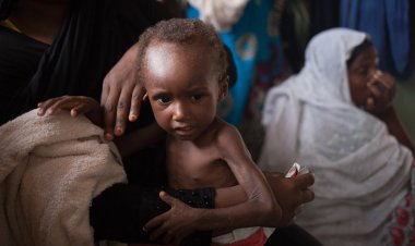 Çad'da nüfusun yüzde 42'si açlıkla mücadele ediyor