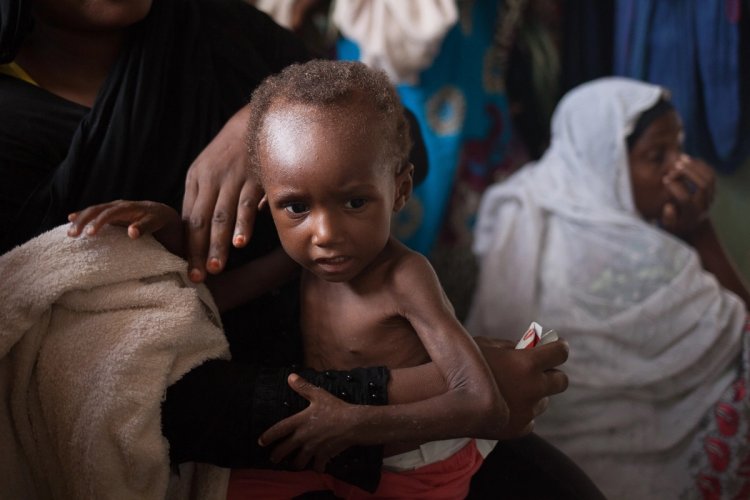 Çad'da nüfusun yüzde 42'si açlıkla mücadele ediyor