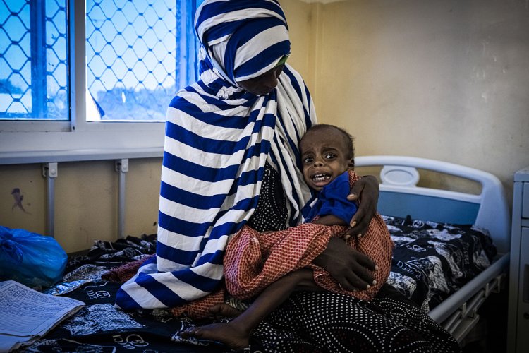 Afrika Boynuzu'nda 5 yaşın altında 7 milyon çocuk yetersiz besleniyor