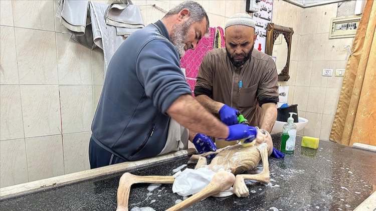 Gazze'de yetersiz beslenme sonucu şehid olan Filistinli çocuktan geriye bir deri bir kemik fotoğrafları kaldı