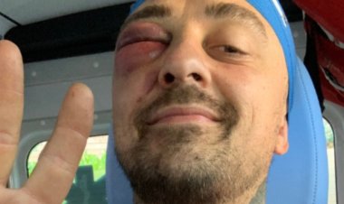 Filistin destekçisi İtalyan şef Rubini siyonist teröristlerce darbedildi