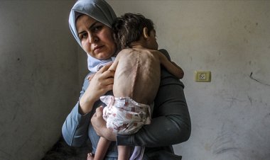 Gazze'de 3 bin 500 çocuk yetersiz beslenmeden ölüm tehlikesi altında