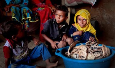 Yemen'de çocukların yüzde 50'sinde kronik yetersiz beslenme görülüyor