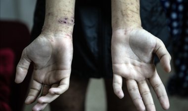 Gazzeli tutuklular, en korkunç koşullara maruz kalıyor