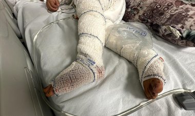 MSF: Gazze'de yanık hastaları sonsuz acılar çekiyor