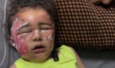 Gazzeli minik Hanin, İsrail'in düzenlediği saldırıda ailesiz kaldı