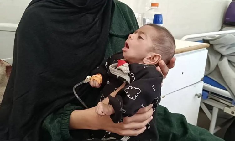 Gazze'de bir bebek daha açlıktan dolayı şehid oldu
