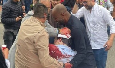 Kolombiya’da sağcı başkan adayı Uribe Turbay’a silahlı saldırı