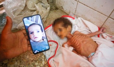 Gazze açlıktan ölüyor: Son 24 saatte 19 kişi hayatını kaybetti