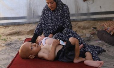 Gazze'de çocuklar 'açlıktan ağlıyor'