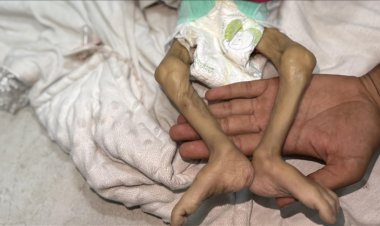 Gazze Şeridi'nde son 24 saatte 1'i çocuk 14 Filistinli açlıktan şehit oldu