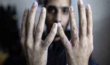 Siyonist İsrail, Filistinli esirleri kasten enfekte ederek sistematik işkenceye devam ediyor