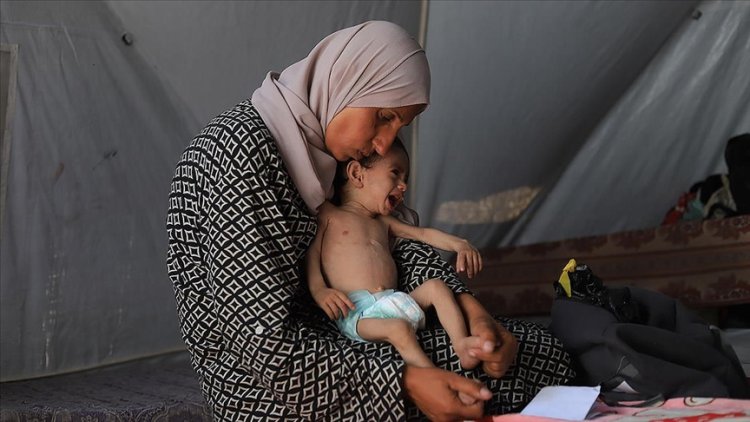 UNICEF: Haziran ayında Gazze’de 5800 çocuğa yetersiz beslenme teşhisi konuldu