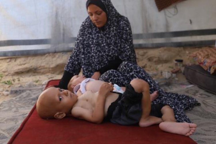Gazze'de çocuklar 'açlıktan ağlıyor'