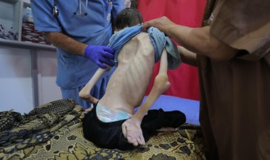 Gazze'de son 24 saatte 2'si çocuk 3 kişi daha açlıktan hayatını kaybetti