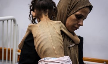 Katil İsrail’in kıtlığa sürüklediği Gazze’de 9 yaşındaki Meryem 10 kiloya düştü