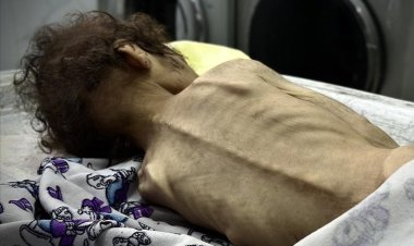 Gazze Şeridi'nde son 24 saatte 2’si çocuk 4 kişi daha açlıktan hayatını kaybetti