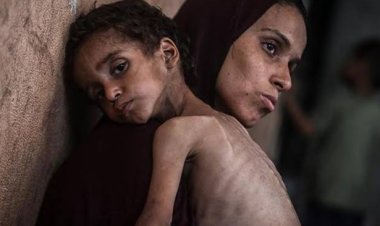 Gazze'de açlık felaketi: 106'sı çocuk 235 şehit