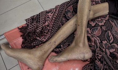 Gazze'de son 24 saatte 3'ü çocuk 10 kişi daha açlıktan şehit oldu