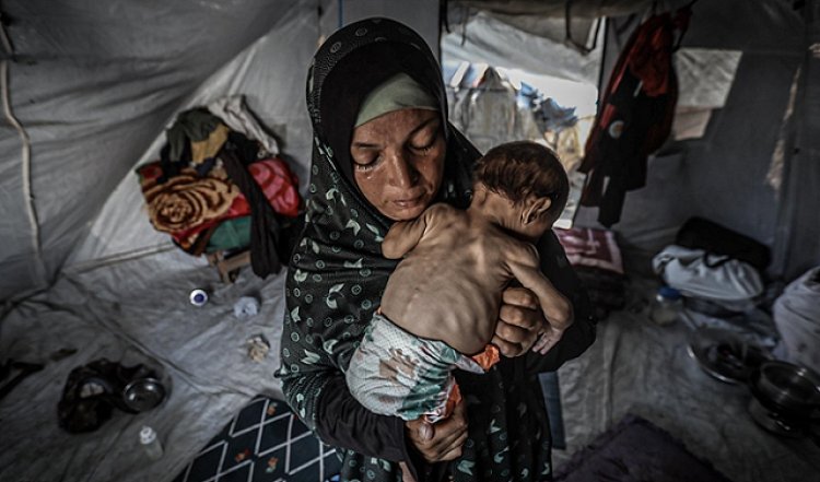 Gazze'de açlıktan şehit olanların sayısı 115'i çocuk olmak üzere 289'a yükseldi