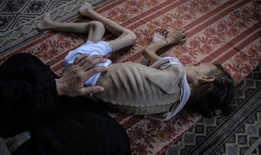 Gazze'de açlıktan hayatını kaybedenlerin sayısı 367'ye çıktı