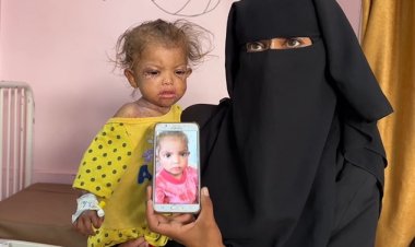 Gazze'de hastanelerdeki çocuklar adeta ölümü bekliyor