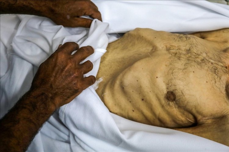 İsrail'in kıtlığı dayattığı Gazze'de son 24 saatte 7 kişi daha açlıktan şehit oldu
