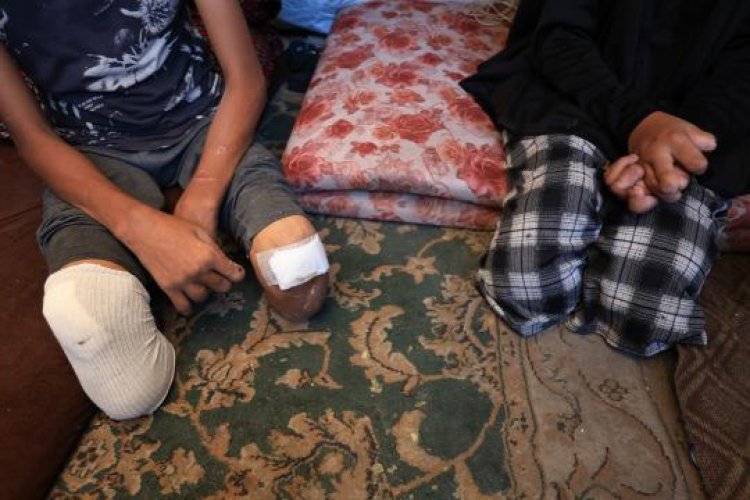 BM Komiseri: 7 Ekim'den bu yana Gazze'de 4 bin çocuk ampute edildi