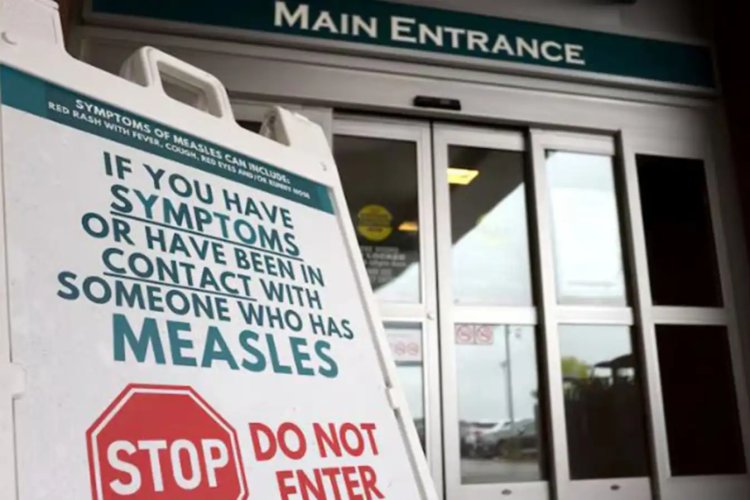 Kanada'da kızamık vakalarında artış 