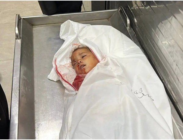 Soykırımcı İsrail 3 yaşındaki bebeği katletti