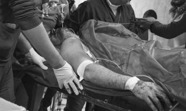 YPG'nin Halep'teki saldırılarında 7 kişi öldü, 52 kişi yaralandı