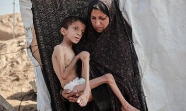 BM: Gazze'de akut yetersiz beslenme vakaları 95 bine dayandı